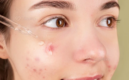 Targeted Skincare Treatments Image